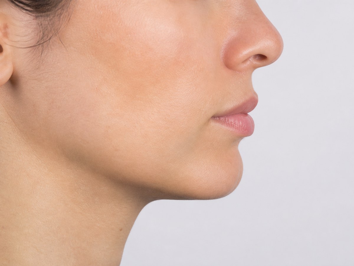 Mentoplastia y perfilado facial